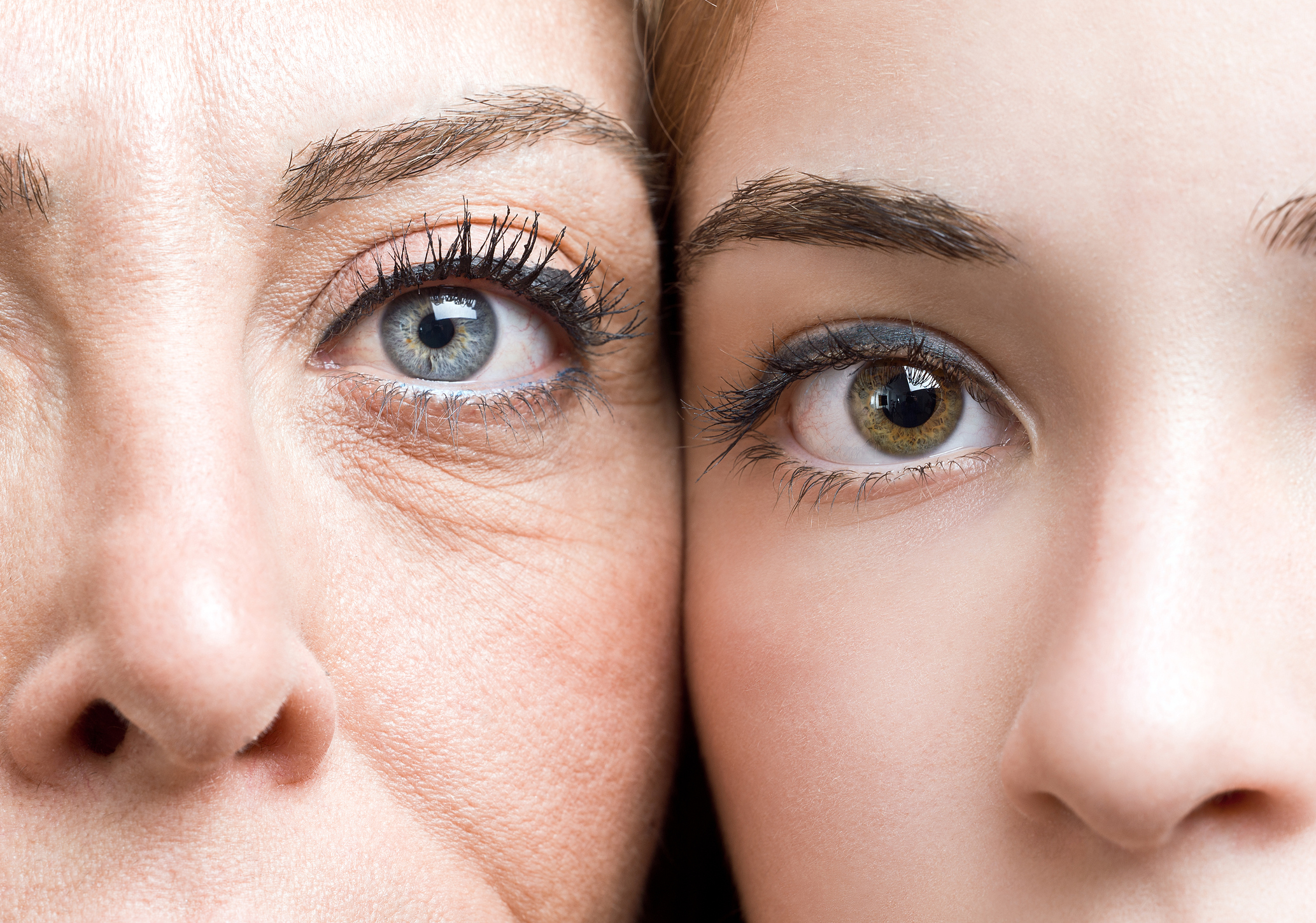 Мама поцелую морщинки. Старение кожи вокруг глаз. Морщины вокруг глаз. Морщины у глаз. Мимические морщины под глазами.