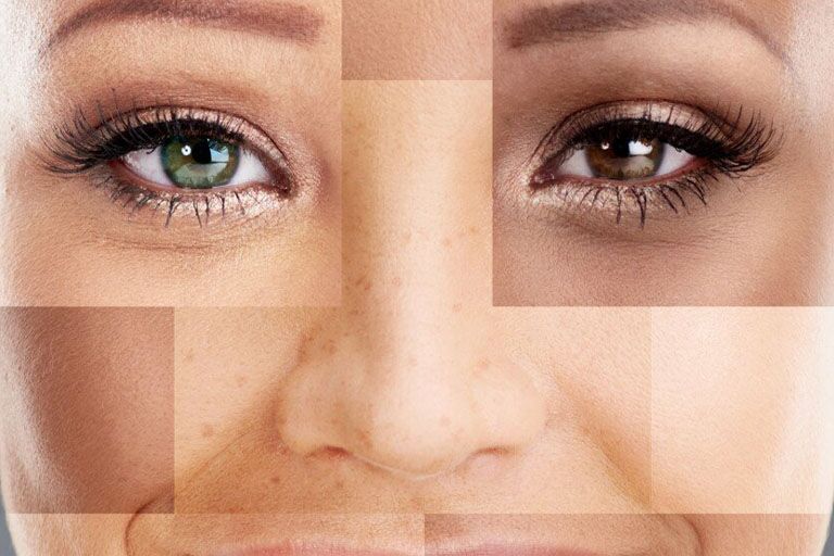 kak opredelit svoj ottenok kozhi