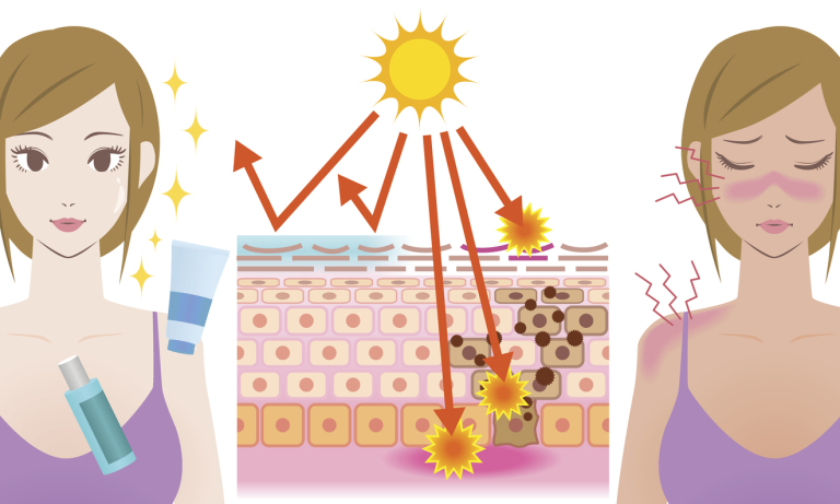 влияние солнечных лучей на кожу
